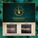 Indulekha Svetakutaja Ayurvedic Hair Oil 100 ml|Ayurvedic Medicinal oil for dandruff treatment with Svetakutaja-Comb Applicator Bottle for Men & Women