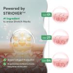 Mylo Care Stretch Marks Combo (Stretch Mark Oil - 100 ml, Stretch Marks Cream - 100 ml) |Stretch Marks removal for women